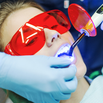 Closeup patient receiving dental sealants