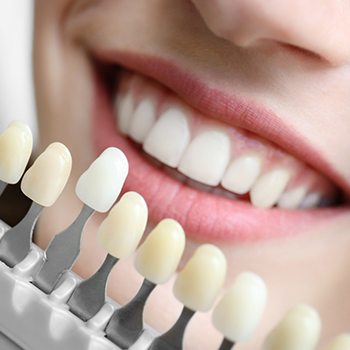 Color-matching process for cosmetic dentistry in Wylie, TX