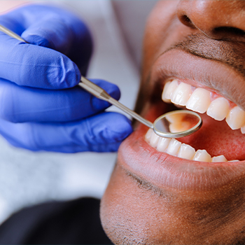 Closeup of smile during dental exam