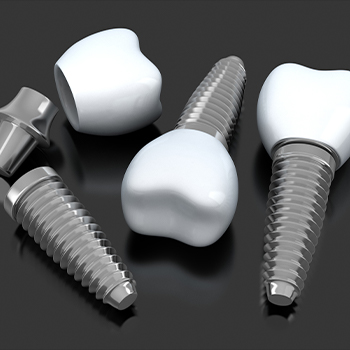 Graphic depicting a series of dental implants