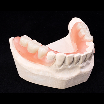 Model smile with partial denture