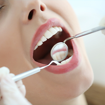 closeup of patient during dental exam
