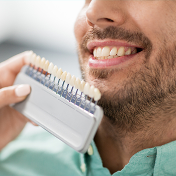 Man's smile compared with tooth color chart