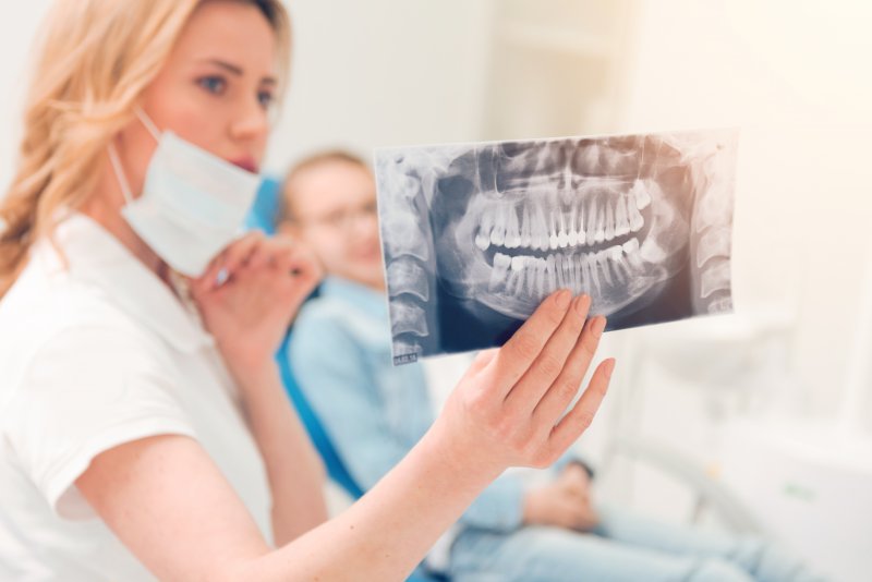 dentist showing patient wisdom teeth x-rays