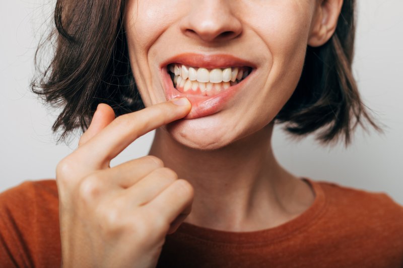 a woman showing symptoms of gum disease in Wylie